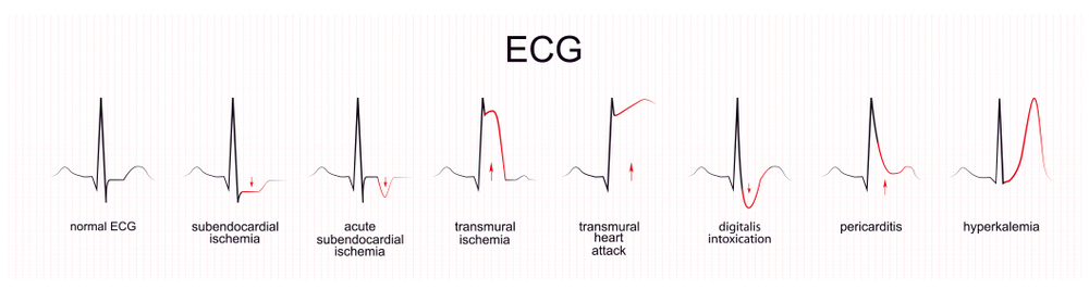 ECG near me